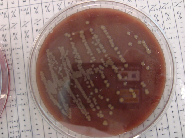 Antibiotiques : Salmonella et Campylobacter affichent de hauts niveaux de résistance chez l’homme et l’animal