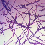 Anthrax charbon Bacillus_anthracis_Gram