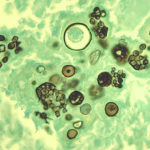 champignon zoonose-Coccidioides_immitis_01ee057_lores