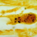 Leptospirosis_in_kidney